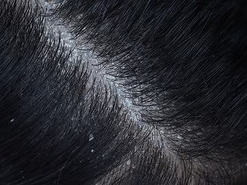 Anti-Dandruff